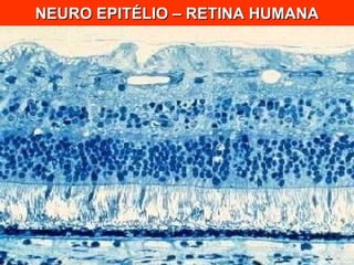 NEURO EPITÉLIO – RETINA HUMANA 