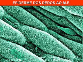 EPIDERME DOS DEDOS AO M.E. 
