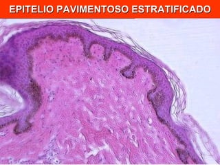 EPITELIO PAVIMENTOSO ESTRATIFICADO 