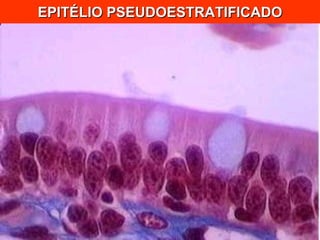 EPITÉLIO PSEUDOESTRATIFICADO 