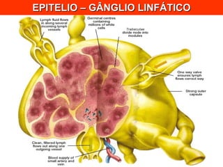 EPITELIO – GÂNGLIO LINFÁTICO 