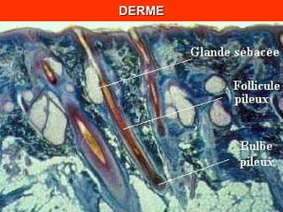 DERME 