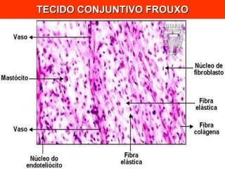 TECIDO CONJUNTIVO FROUXO 