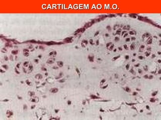 CARTILAGEM AO M.O. 
