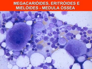 MEGACARIÓIDES, ERITRÓIDES E MIELÓIDES - MEDULA ÓSSEA  