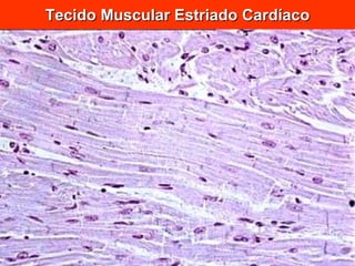 Tecido Muscular Estriado Cardíaco 