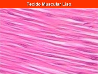 Tecido Muscular Liso 