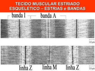 TECIDO MUSCULAR ESTRIADO ESQUELETICO – ESTRIAS e BANDAS 