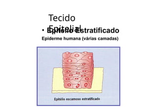 Tecido
Epitelial
• Epitélio Estratificado
Epiderme humana (várias camadas)
 