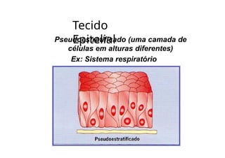 Tecido
Epitelial
Pseudoestratificado (uma camada de
células em alturas diferentes)
Ex: Sistema respiratório
 