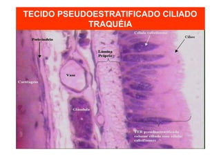 TECIDO PSEUDOESTRATIFICADO CILIADO
TRAQUÉIA
 