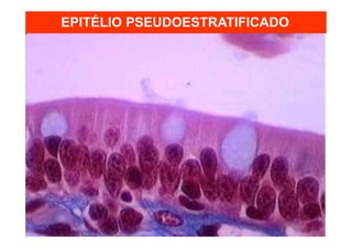 EPITÉLIO PSEUDOESTRATIFICADO
 