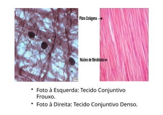 • Foto à Esquerda: Tecido Conjuntivo
Frouxo.
• Foto à Direita: Tecido Conjuntivo Denso.
 