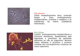 Célula
Fibroblasto
Célula metabolicamente ativa, contendo
longos e finos prolongamentos
citoplasmáticos. Sintetiza o colágeno e as
substâncias da matriz (substância
intercelular).
Macrófago
Contém prolongamentos citoplasmáticos e
inúmeros lisossomos. Responsáveis pela
fagocitose e pinocitose de partículas
estranhas ou não ao organismo. Remove
restos celulares e promove o primeiro
combate aos microrganismos invasores do
nosso organismo.
 