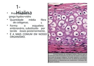 1-
Hialina
• Proveniente do
grego hyalos=vidro
• Quantidade média
de colágenas.
fibra
s
• Forma o esqueleto
embrionário, substituído por
tecido ósseo posteriormente.
• É A MAIS COMUM EM NOSSO
ORGANISMO.
 