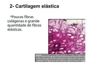 2- Cartilagem elástica
•Poucas fíbras
colágenas e grande
quantidade de fíbras
elásticas.
 