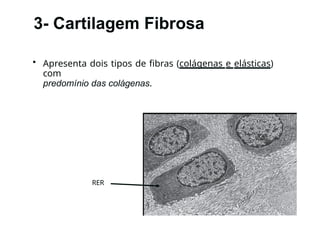 3- Cartilagem Fibrosa
• Apresenta dois tipos de fibras (colágenas e elásticas)
com
predomínio das colágenas.
RER
 