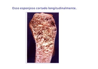 Osso esponjoso cortado longitudinalmente.
 