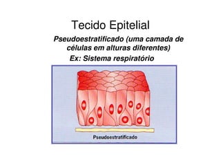 Tecido Epitelial
Pseudoestratificado (uma camada de
   células em alturas diferentes)
    Ex: Sistema respiratório
 