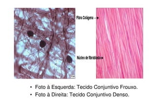 • Foto à Esquerda: Tecido Conjuntivo Frouxo.
• Foto à Direita: Tecido Conjuntivo Denso.
 