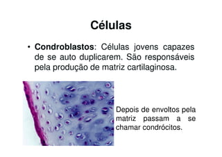 Células
• Condroblastos: Células jovens capazes
  de se auto duplicarem. São responsáveis
  pela produção de matriz cartilaginosa.



                     Depois de envoltos pela
                     matriz passam a se
                     chamar condrócitos.
 