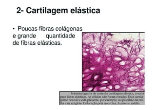 2- Cartilagem elástica

• Poucas fíbras colágenas
e grande     quantidade
de fíbras elásticas.
 