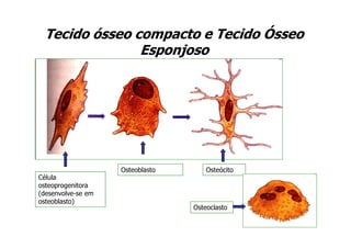 Tecido ósseo compacto e Tecido Ósseo
                Esponjoso




                    Osteoblasto       Osteócito
Célula
osteoprogenitora
(desenvolve-se em
osteoblasto)
                                  Osteoclasto
 