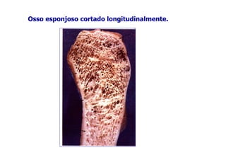 Osso esponjoso cortado longitudinalmente.
 