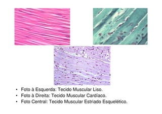 Corpo celular – núcleo e               Bainha de Mielina
maioria das organelas                  – células de
citoplasmátic...