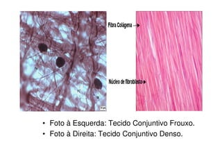 TECIDO CONJUNTIVO DENSO


Denominado de tecido conjuntivo fibroso, apresenta
grande quantidade de fibras colágenas, forman...