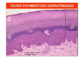 TECIDO PAVIMENTOSO QUERATINIZADO

 