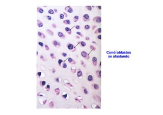 Condroblastos
se afastando

 