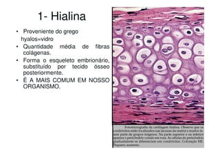 1- Hialina
• Proveniente do grego
hyalos=vidro
• Quantidade média de fibras
colágenas.
• Forma o esqueleto embrionário,
substituído por tecido ósseo
posteriormente.
• É A MAIS COMUM EM NOSSO
ORGANISMO.

 