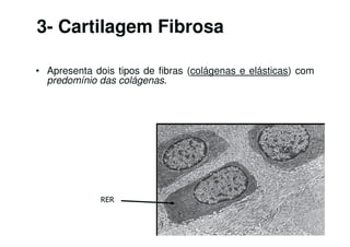3- Cartilagem Fibrosa
• Apresenta dois tipos de fibras (colágenas e elásticas) com
predomínio das colágenas.

RER

 