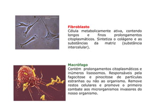 Célula
Fibroblasto
Célula metabolicamente ativa, contendo
longos e finos prolongamentos
citoplasmáticos. Sintetiza o colágeno e as
substâncias da matriz (substância
intercelular).
Macrófago
Contém prolongamentos citoplasmáticos e
inúmeros lisossomos. Responsáveis pela
fagocitose e pinocitose de partículas
estranhas ou não ao organismo. Remove
restos celulares e promove o primeiro
combate aos microrganismos invasores do
nosso organismo.
 