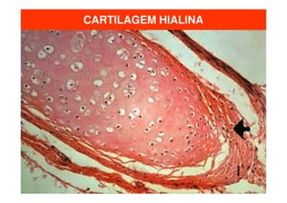 CARTILAGEM HIALINA
 
