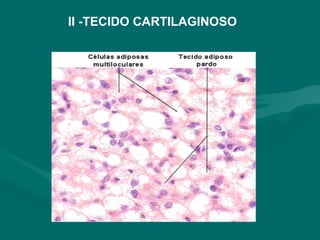 II -TECIDO CARTILAGINOSO
 