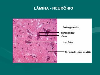 LÂMINA - NEURÔNIO
 