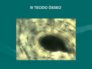 III TECIDO ÓSSEO
 