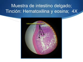 Muestra de intestino delgado; Tinción: Hematoxilina y eosina;  4X Vellosidades Intestinales