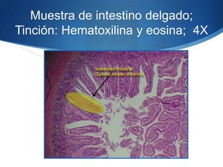 Muestra de intestino delgado; Tinción: Hematoxilina y eosina;  4X Vellosidad Intestinal (Epitelio simple cilíndrico)