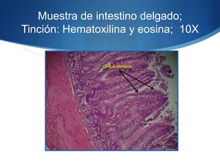 Muestra de intestino delgado; Tinción: Hematoxilina y eosina;  10X Chapa estriada