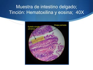 Muestra de intestino delgado; Tinción: Hematoxilina y eosina;  40X Chapa estriadaEpitelio simple cilíndrico