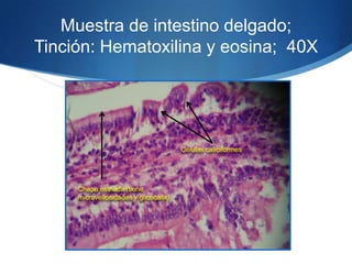 Muestra de intestino delgado; Tinción: Hematoxilina y eosina;  40X Células caliciformesChapa estriada (tiene microvellosidades y glicocalix)