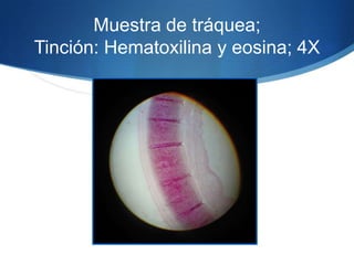 Muestra de tráquea; Tinción: Hematoxilina y eosina; 4X 