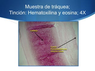 Muestra de tráquea; Tinción: Hematoxilina y eosina; 4X CartilagoEpitelio Pseudoestratificado cilíndrico ciliado 