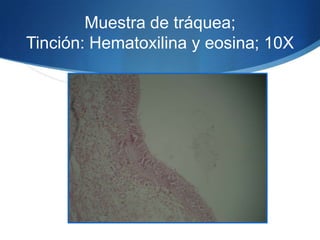 Muestra de tráquea; Tinción: Hematoxilina y eosina; 10X 