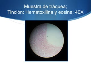 Muestra de tráquea; Tinción: Hematoxilina y eosina; 40X 