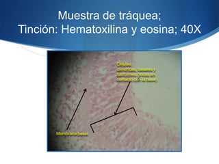 Muestra de tráquea; Tinción: Hematoxilina y eosina; 40X Células  cilindricas, basales y fusiformes (todas en contacto con la base)Membrana basal