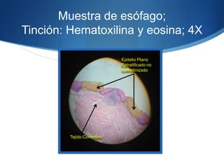 Muestra de esófago; Tinción: Hematoxilina y eosina; 4X Epitelio Plano Estratificado no queratinizadoTejido Conectivo